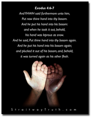 Hand Bosom - Exodus 4:6-7 www.StraitwayTruth.com